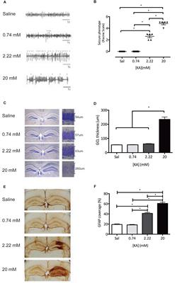 Co-administration of Anti microRNA-124 and -137 Oligonucleotides Prevents Hippocampal Neural Stem Cell Loss Upon Non-convulsive Seizures